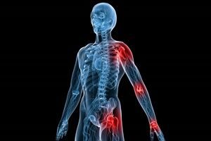 What is Referred Pain