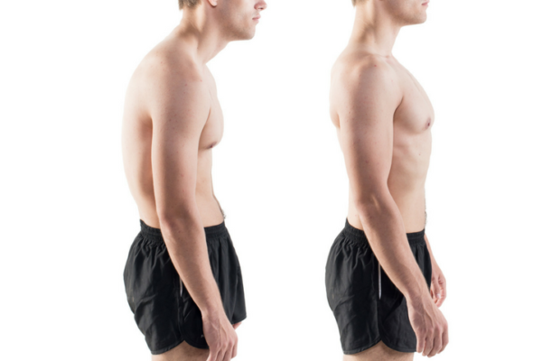 How Chiropractic Helps Improve Posture