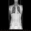 Why Chiropractors Use X-rays As A Diagnostic Tool For Treatment