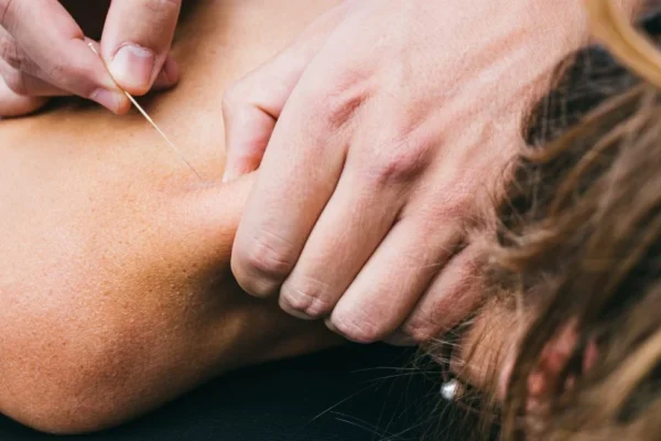 How Chiropractic Helps Relieve Trigger Points & Other Myofascial Pain