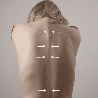 4 Benefits of Getting a Scoliosis Screening from a Chiropractor